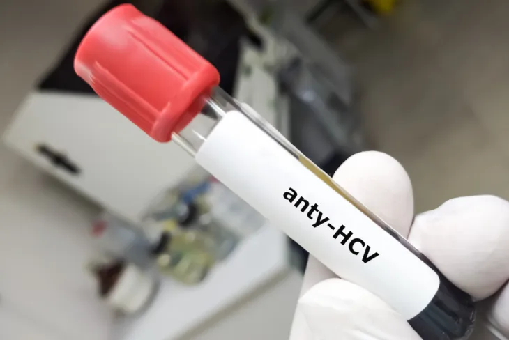 Anty-HCV to przeciwciała przeciwko wirusowemu zapaleniu wątroby typu C obecne we krwi osób mających w przeszłości kontakt z wirusem. /Fot. Adobe Stock