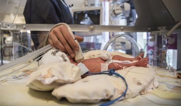 Wcześniactwo – czym charakteryzuje się i jak rozwija się wcześniak?