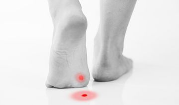 Kurzajki i ich leczenie